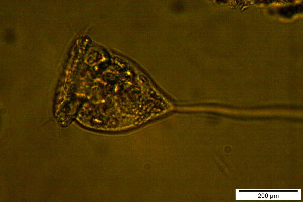Mikrokosmos Ciliaten, hier der Einzeller Vorticella, sind ein leicht zu kultivierendes Brutfutter und können auch zur Copepodenmast eingesetzt werden.